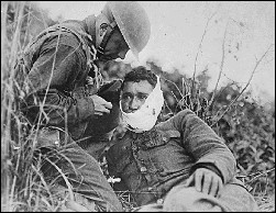 Wounded, 1918